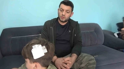 Yalova&rsquo;daki komşu kavgasında bu kez 8 yaşındaki &ccedil;ocuğa taşlı saldırı

