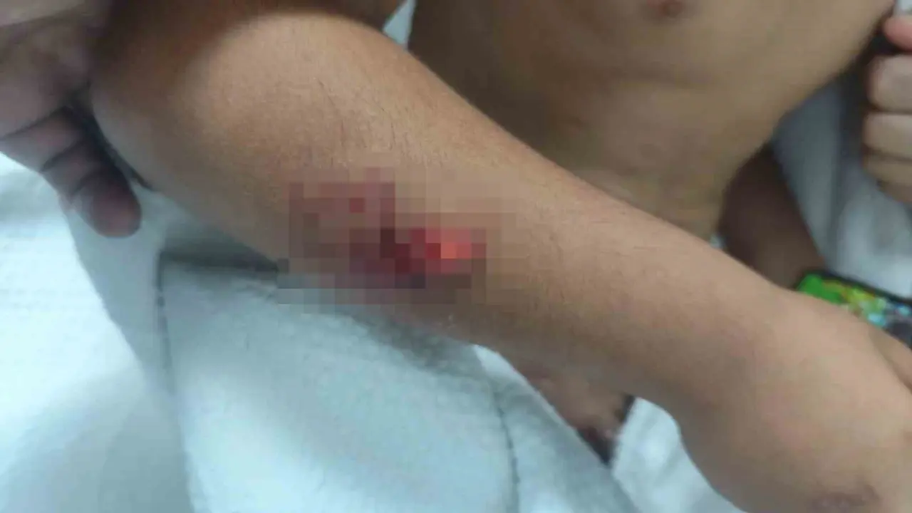 Viranşehir'de sahipsiz köpeklerin saldırdığı öğrenci yaralandı