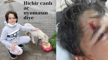8 köpeğin saldırısında yaralanan Ömer Efe, sokak hayvanları projesinde görev almış