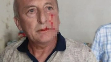 CHP'li Yarbaşı Belediye Başkanı Kaynar'a dayısından yumruklu saldırı 