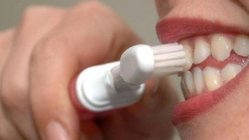 Gaziantep Diş Hekimi Uyarıyor: İnternetten Diş Beyazlatma Ürünleri Zararlı Olabilir