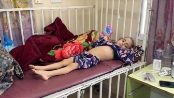 Gazze'de İsrail Saldırıları Sonucu Beslenme Sorunu Yaşayan 9 Yaşındaki Çocuklar Acil Yardım Bekliyor