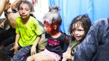 Gazze'de ameliyatlar anestezisiz yapılıyor: Ya bu acıyı çekecekler ya da ölecekler