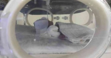 Helikopter ambulansla Şanlıurfa’ya getirilen 775 gramlık bebeğin tedavisi sürüyor