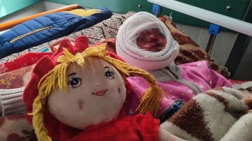 İsrail’in saldırılarında yüzü yanan 4 yaşındaki Seca, tedavi için bekliyor
