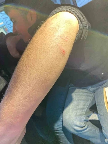 Siirt’te oto sanayisinde sokak köpeklerinin saldırdığı genç yaralandı
