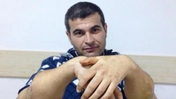 Türkiye&rsquo;de çift kol nakli yapılan 4'üncü kişiydi: Depremde hayatını kaybetti
